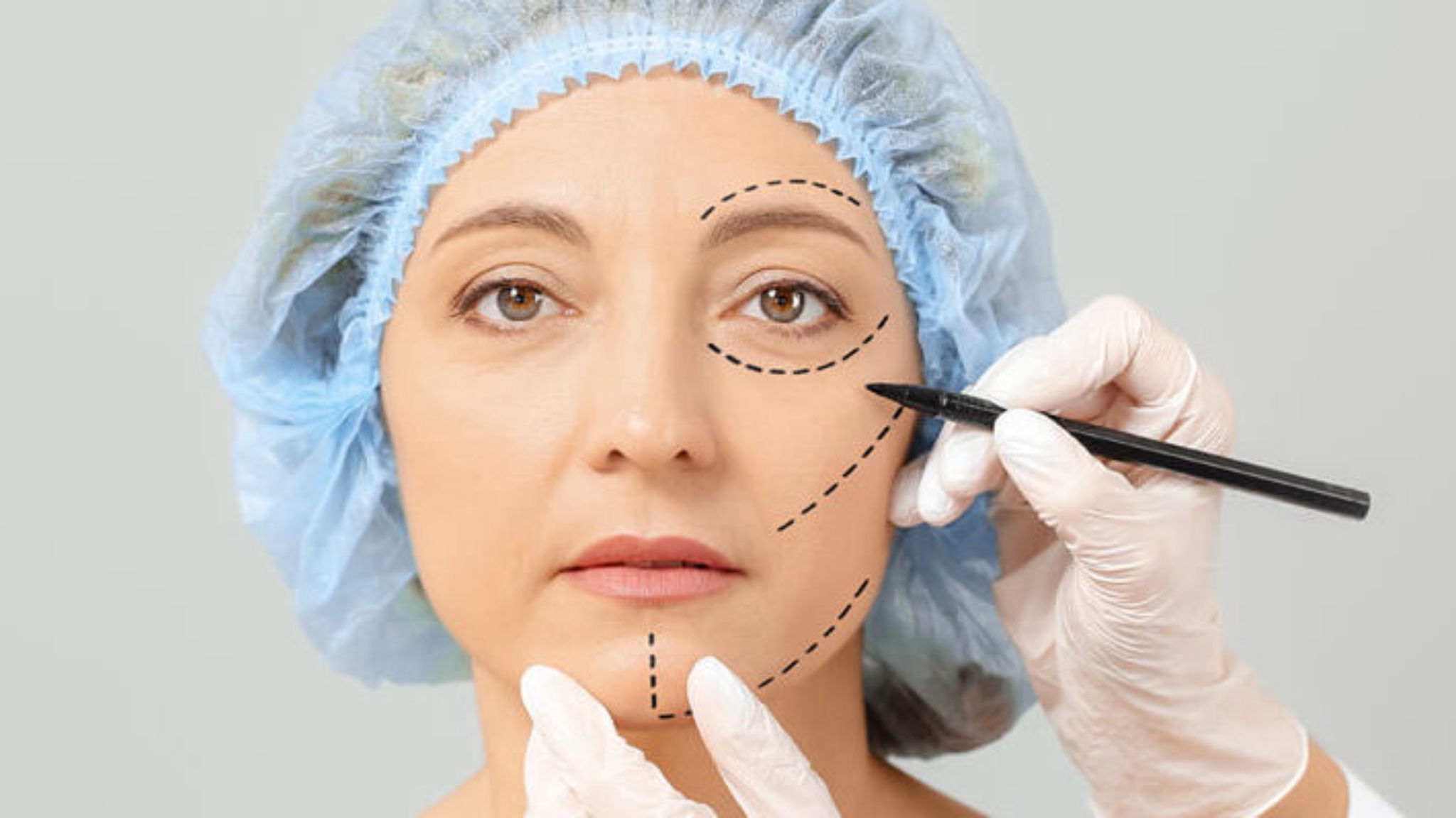 cirugia-estetica-2026-menos-cambios-visibles-mas-naturalidad-y-precision-5