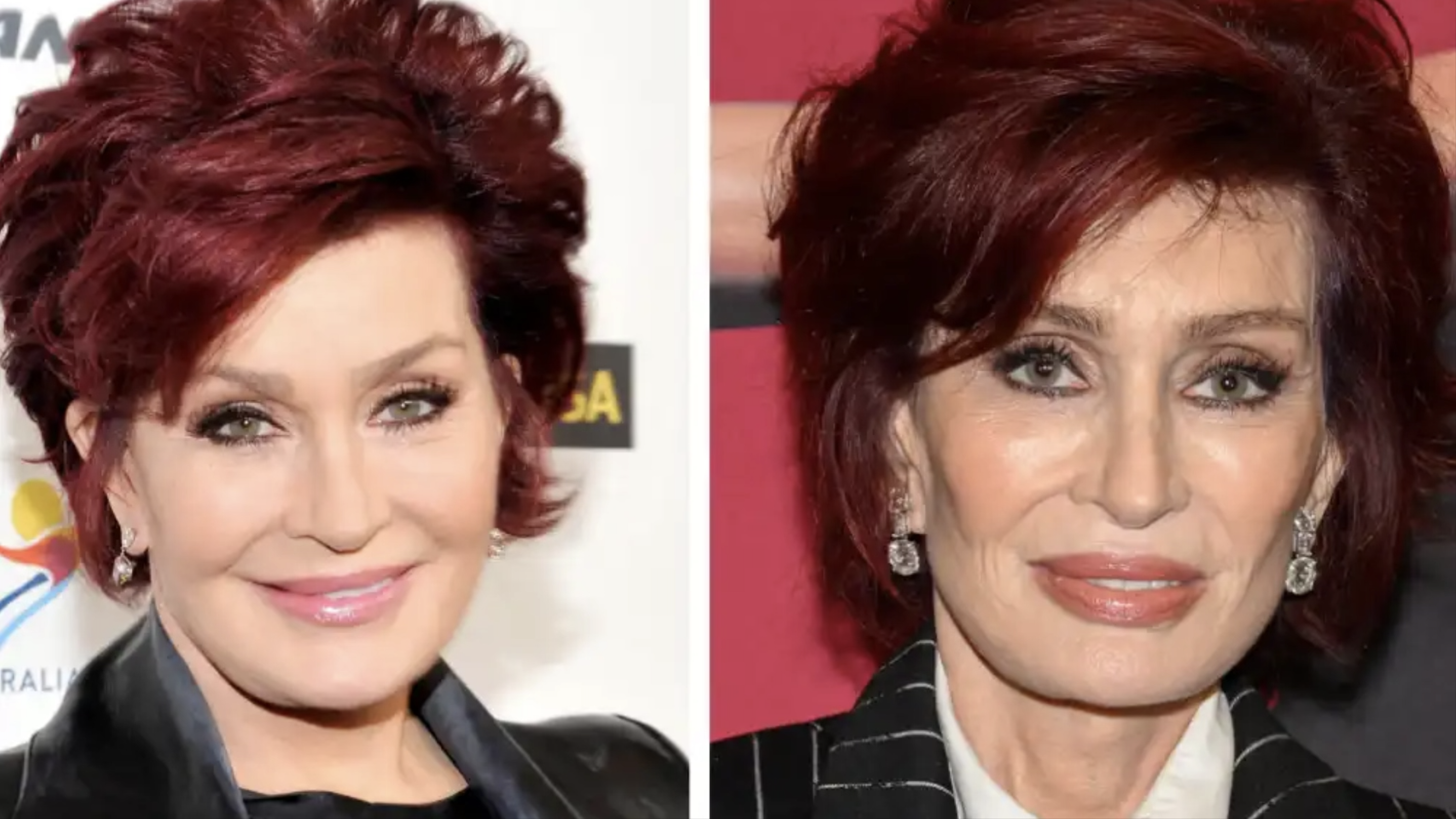 Ozempic face y Ozempic butt: los cambios estéticos que nadie te explicó