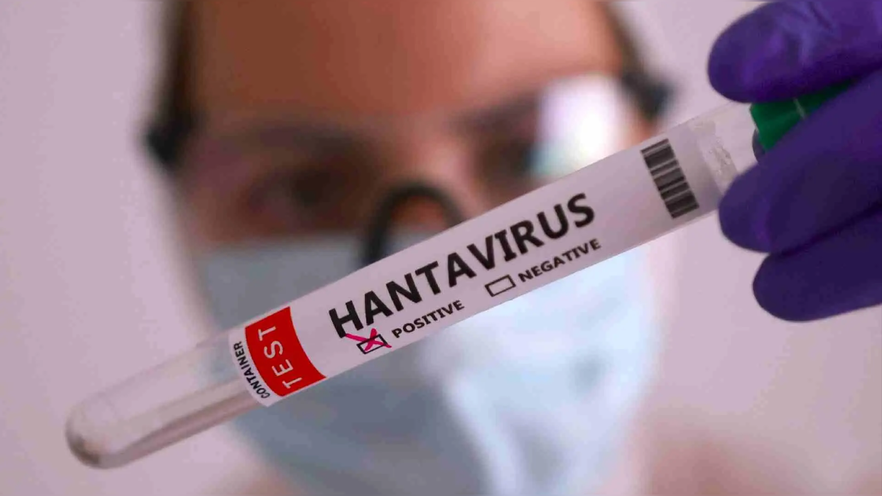 todo-sobre-el-hantavirus-sintomas-contagio-y-riesgo-real-tras-el-brote-en-un-crucero